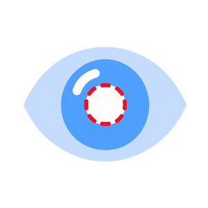 Cataract Surgery