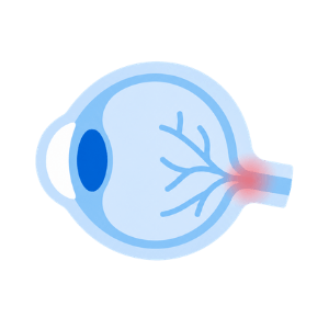 Glaucoma